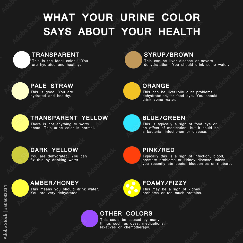 Urine color